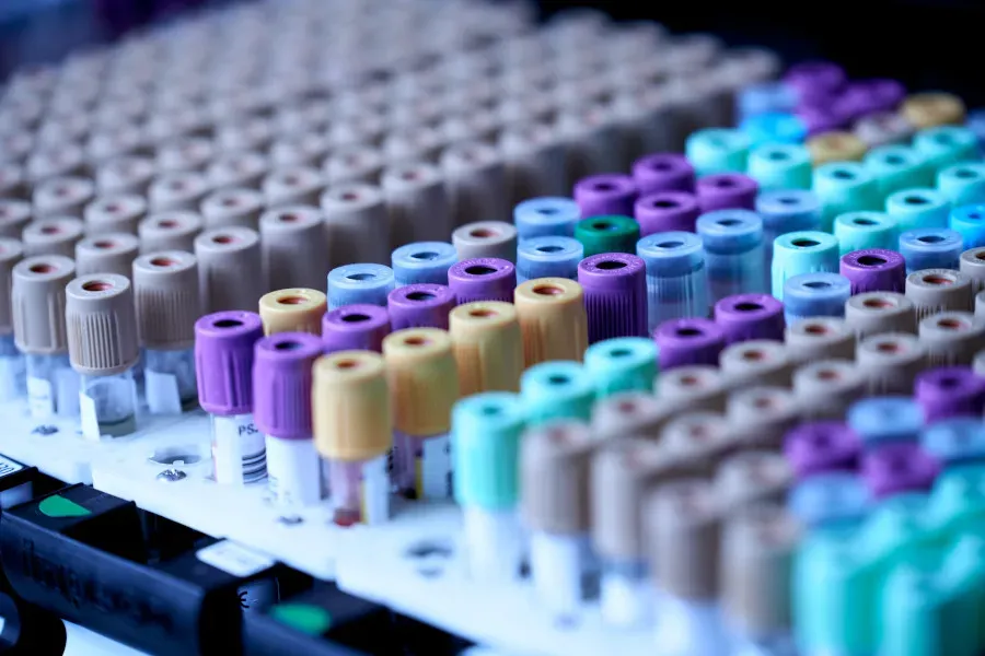 Odoo ERPGAP Blog Cover Image